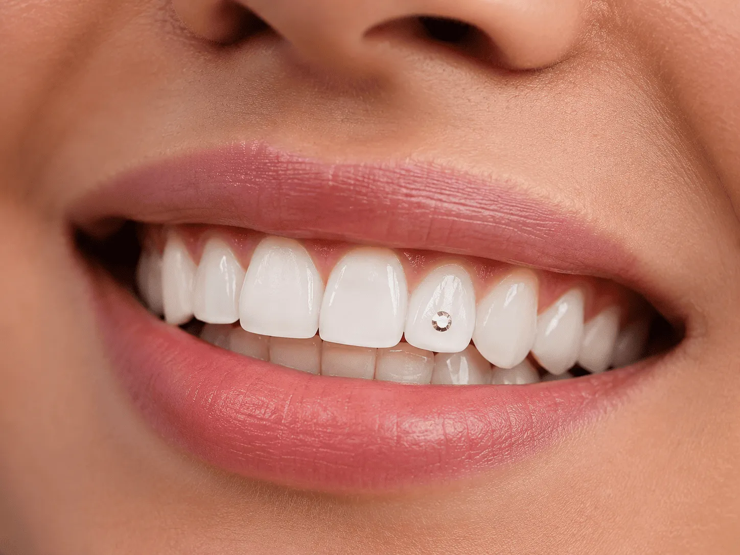 Dental Jewellary